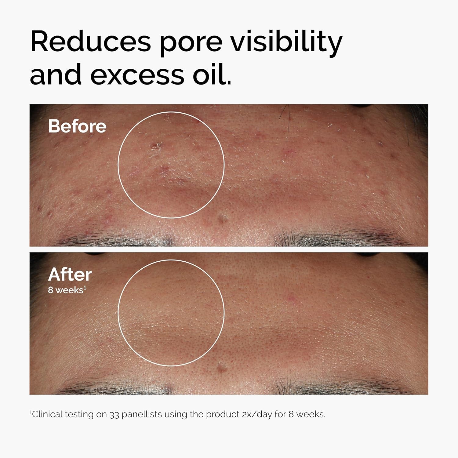 Niacinamide 10% + Zinc 1% 30Ml
